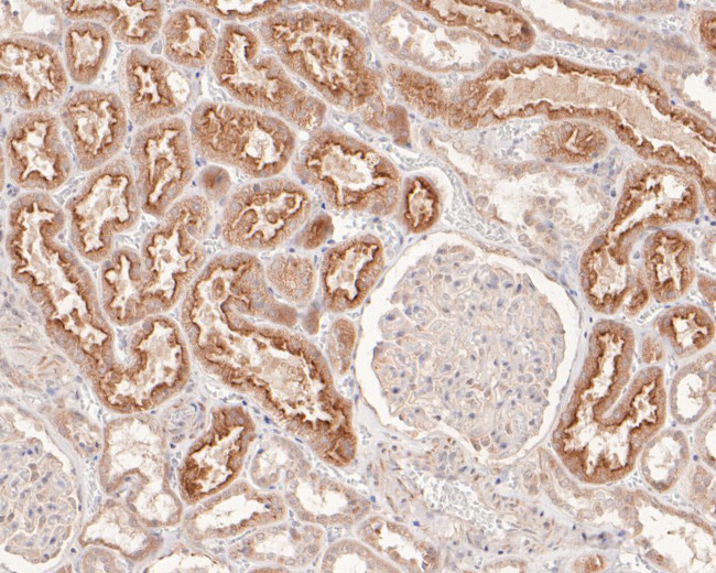 SKI Antibody in Immunohistochemistry (Paraffin) (IHC (P))