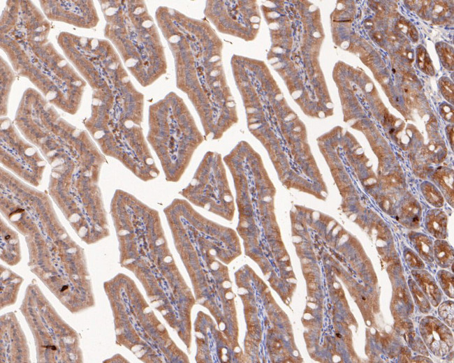 STRAP Antibody in Immunohistochemistry (Paraffin) (IHC (P))