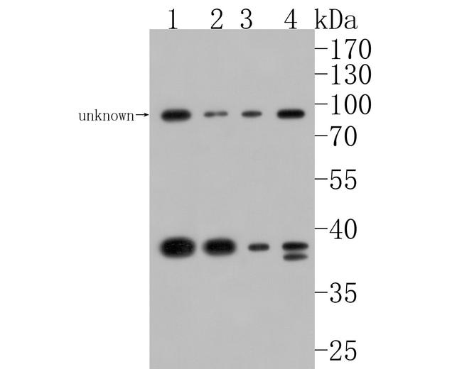 STRAP Antibody in Western Blot (WB)