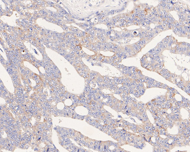 UCRC Antibody in Immunohistochemistry (Paraffin) (IHC (P))