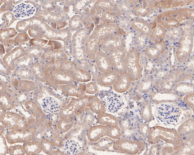 UCRC Antibody in Immunohistochemistry (Paraffin) (IHC (P))