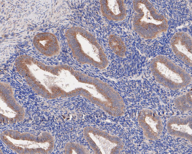 CER1 Antibody in Immunohistochemistry (Paraffin) (IHC (P))