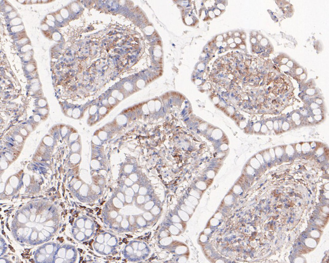 CER1 Antibody in Immunohistochemistry (Paraffin) (IHC (P))