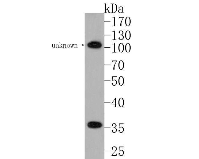 CER1 Antibody in Western Blot (WB)