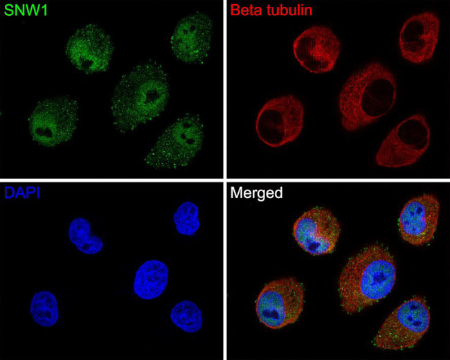 SNW1 Antibody in Immunocytochemistry (ICC/IF)