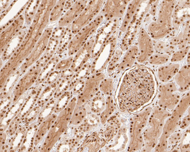 SNW1 Antibody in Immunohistochemistry (Paraffin) (IHC (P))