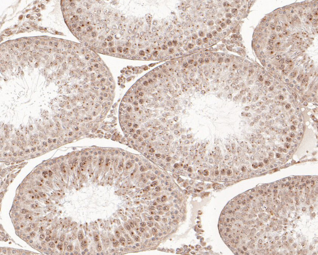 SNW1 Antibody in Immunohistochemistry (Paraffin) (IHC (P))