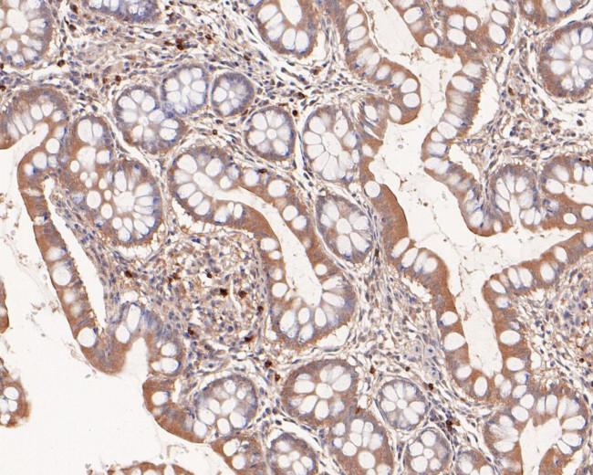 Ribulose-phosphate 3-epimerase Antibody in Immunohistochemistry (Paraffin) (IHC (P))