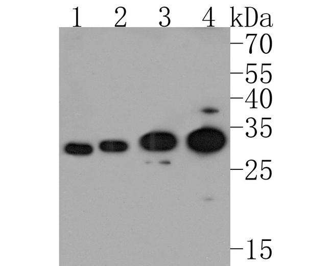 Endothelin 3 Antibody in Western Blot (WB)