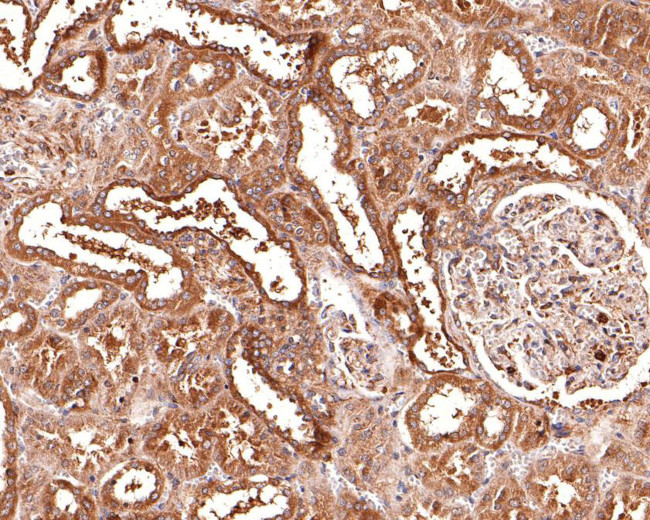 CLCN2 Antibody in Immunohistochemistry (Paraffin) (IHC (P))