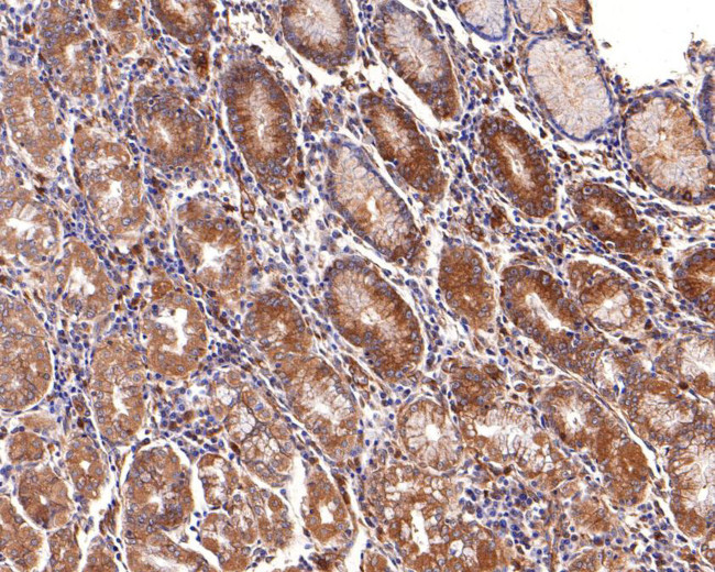 CLCN2 Antibody in Immunohistochemistry (Paraffin) (IHC (P))