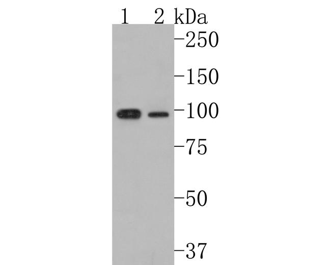 CLCN2 Antibody in Western Blot (WB)