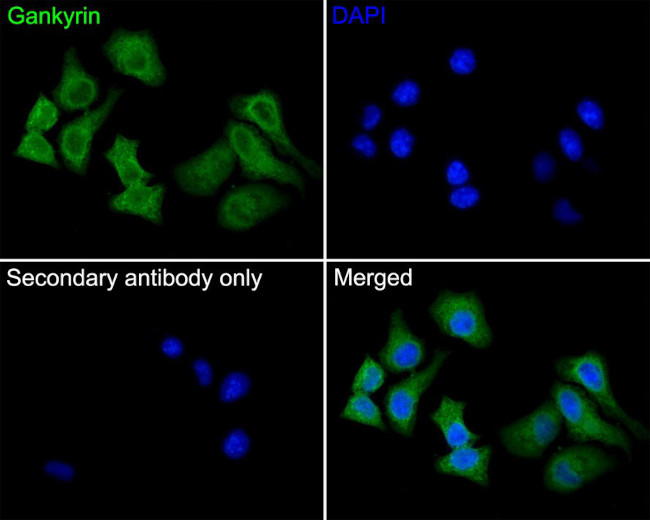 PSMD10 Antibody in Immunocytochemistry (ICC/IF)