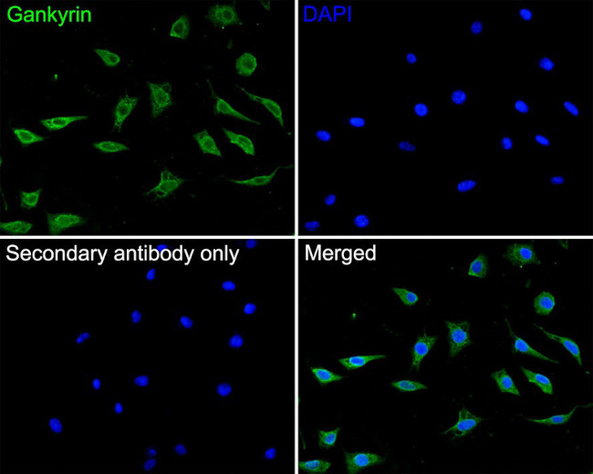 PSMD10 Antibody in Immunocytochemistry (ICC/IF)