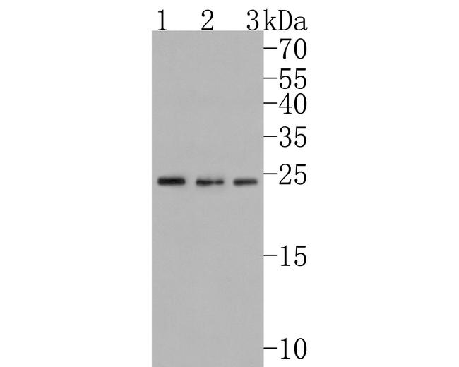 PSMD10 Antibody in Western Blot (WB)