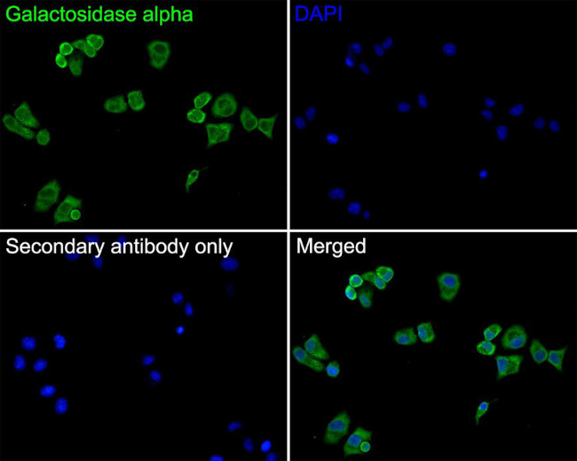 alpha Galactosidase Antibody in Immunocytochemistry (ICC/IF)
