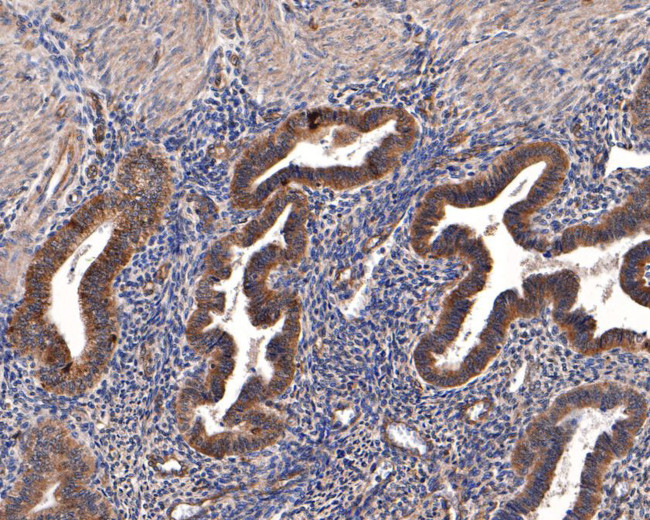 alpha Galactosidase Antibody in Immunohistochemistry (Paraffin) (IHC (P))