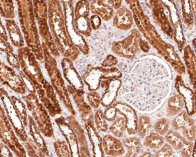 alpha Galactosidase Antibody in Immunohistochemistry (Paraffin) (IHC (P))