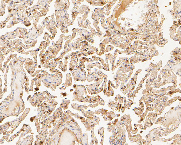 TTK Antibody in Immunohistochemistry (Paraffin) (IHC (P))