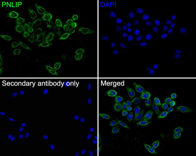 PNLIP Antibody in Immunocytochemistry (ICC/IF)