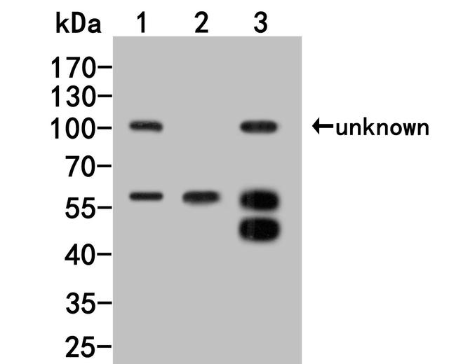 PNLIP Antibody in Western Blot (WB)