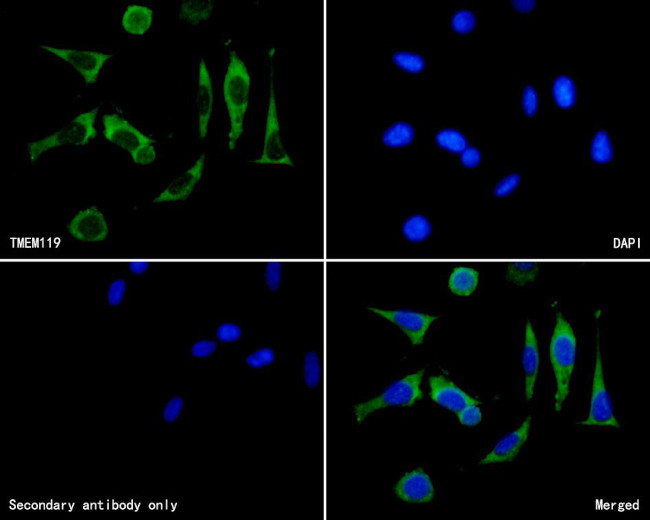 TMEM119 Antibody in Immunocytochemistry (ICC/IF)