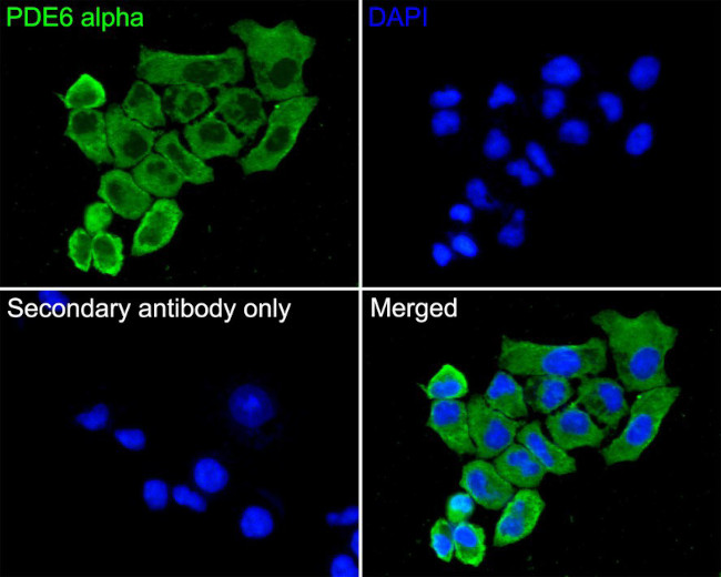 PDE6A Antibody in Immunocytochemistry (ICC/IF)