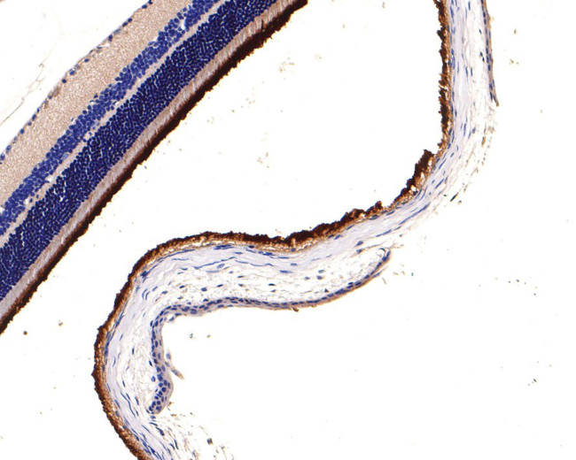 PDE6A Antibody in Immunohistochemistry (Paraffin) (IHC (P))