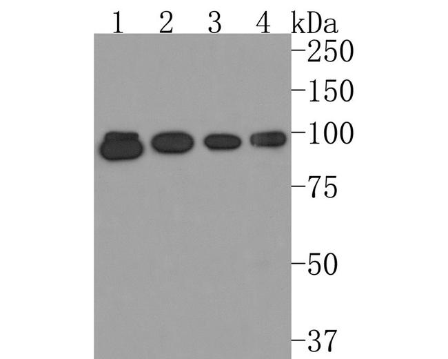 PDE6A Antibody in Western Blot (WB)