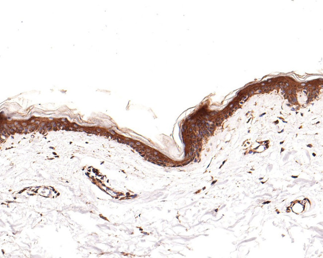 CD116 Antibody in Immunohistochemistry (Paraffin) (IHC (P))