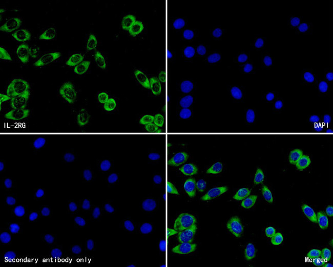 IL2RG Antibody in Immunocytochemistry (ICC/IF)