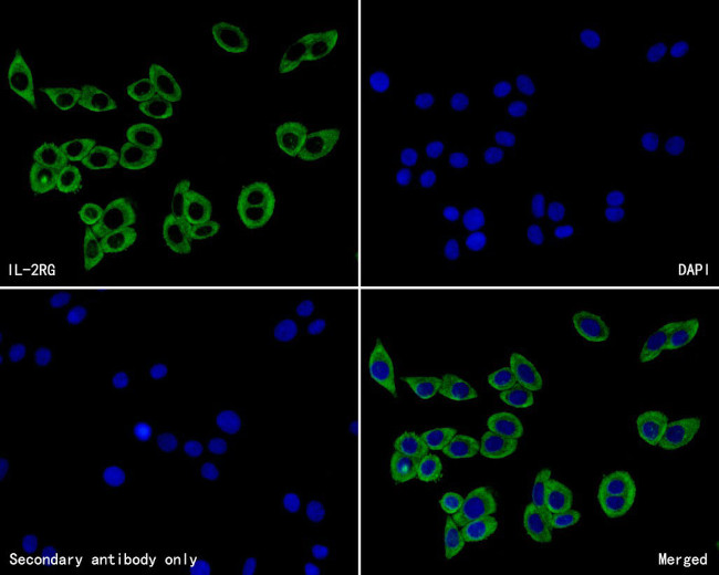 IL2RG Antibody in Immunocytochemistry (ICC/IF)