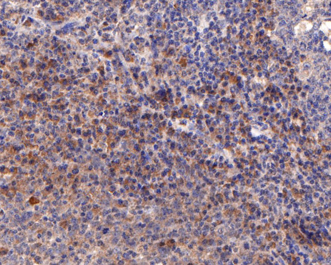 IL2RG Antibody in Immunohistochemistry (Paraffin) (IHC (P))