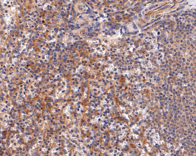 IL2RG Antibody in Immunohistochemistry (Paraffin) (IHC (P))