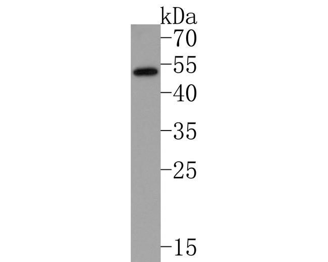 IL2RG Antibody in Western Blot (WB)