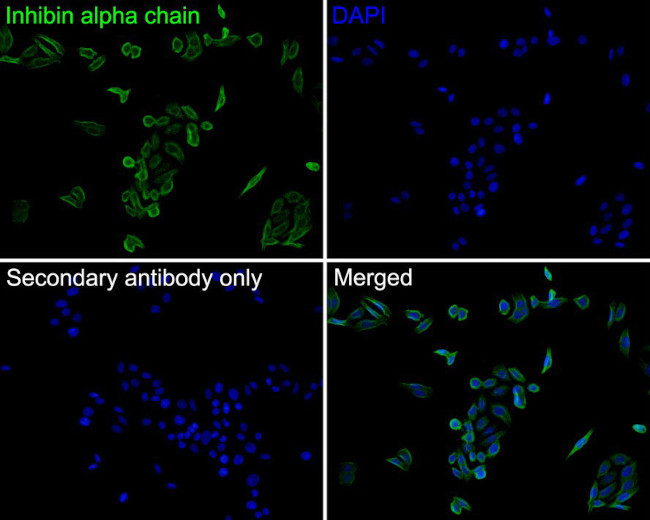 INHA Antibody in Immunocytochemistry (ICC/IF)