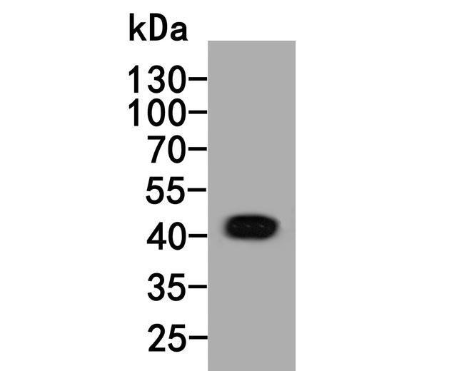 INHA Antibody in Western Blot (WB)