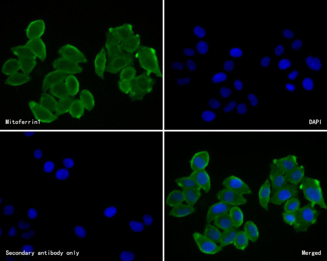 SLC25A37 Antibody in Immunocytochemistry (ICC/IF)