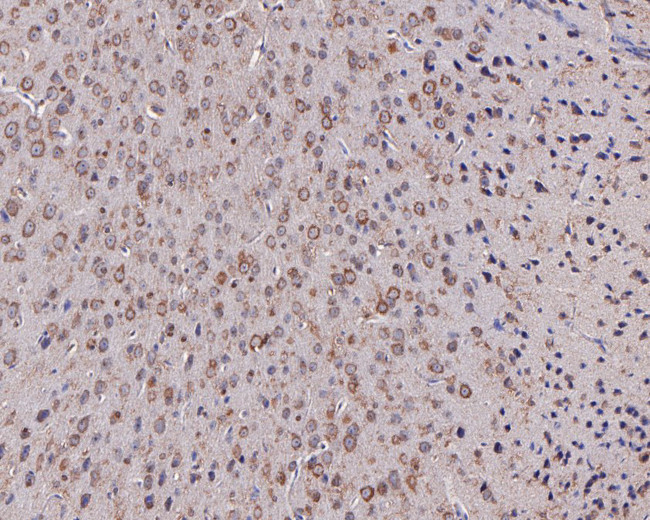 SLC25A37 Antibody in Immunohistochemistry (Paraffin) (IHC (P))