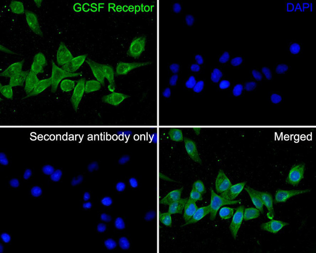 CSF3R Antibody in Immunocytochemistry (ICC/IF)