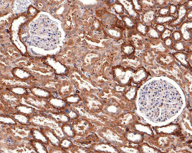 IL20RA Antibody in Immunohistochemistry (Paraffin) (IHC (P))