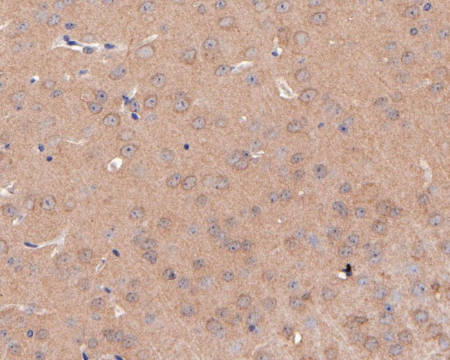 GABRB2 Antibody in Immunohistochemistry (Paraffin) (IHC (P))