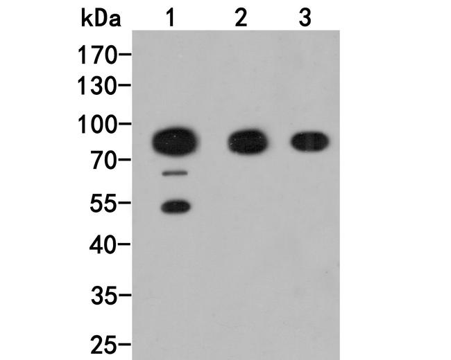 GABRB2 Antibody in Western Blot (WB)