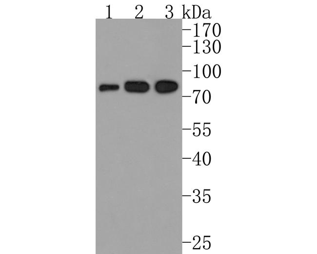 IL21R Antibody in Western Blot (WB)