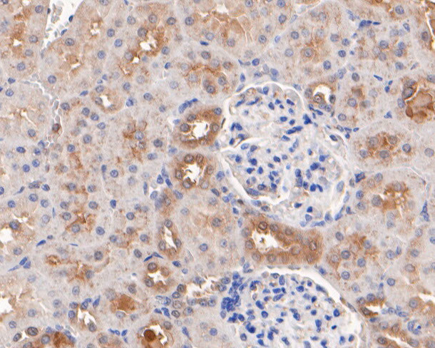 GAB2 Antibody in Immunohistochemistry (Paraffin) (IHC (P))