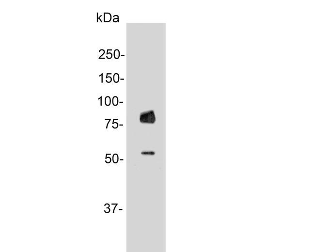 GAB2 Antibody in Western Blot (WB)