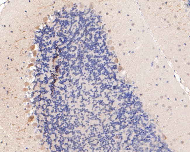 MYT1L Antibody in Immunohistochemistry (Paraffin) (IHC (P))