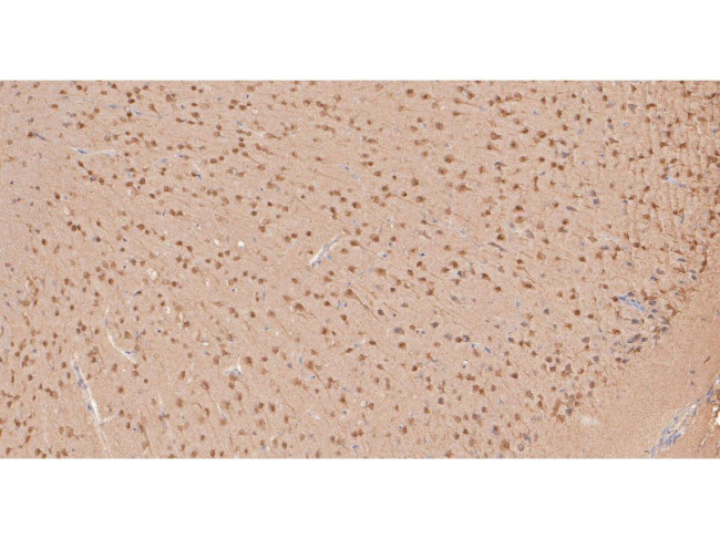 MYT1L Antibody in Immunohistochemistry (Paraffin) (IHC (P))