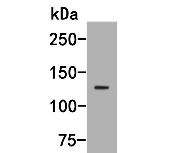 MYT1L Antibody in Western Blot (WB)