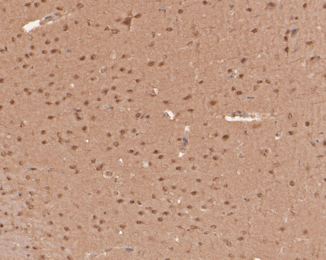 WWTR1 Antibody in Immunohistochemistry (Paraffin) (IHC (P))